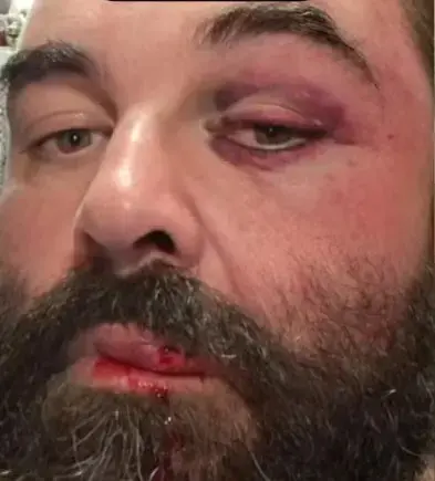 Homem é agredido após reclamar de som alto em igreja